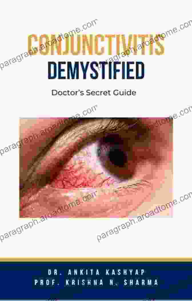 Conjunctivitis Reference Guide Book Cover Conjunctivitis A Reference Guide (BONUS DOWNLOADS) (The Hill Resource And Reference Guide 128)