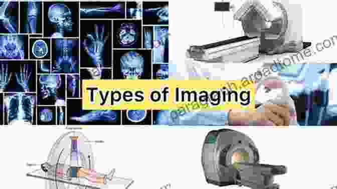 Different Medical Imaging Modalities Pancreatic Cystic Neoplasms: From Imaging To Differential Diagnosis And Management