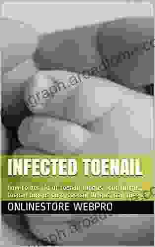 Infected Toenail: How To Get Rid Of Toenail Fungus Foot Fungus Toenail Fungus Cure Toenail Fungus Nail Fungus