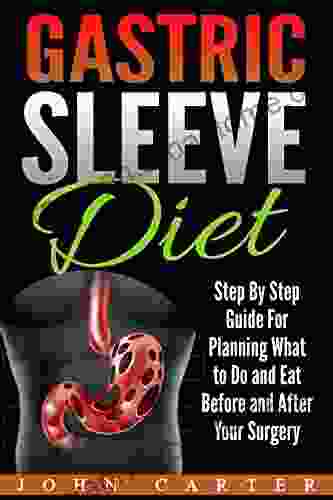 Gastric Sleeve Diet: Step By Step Guide For Planning What to Do and Eat Before and After Your Surgery (Gastric Sleeve Surgery)